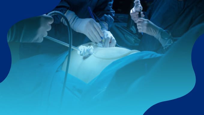 Los mejores Cirujanos Generales y Laparoscópicos en México