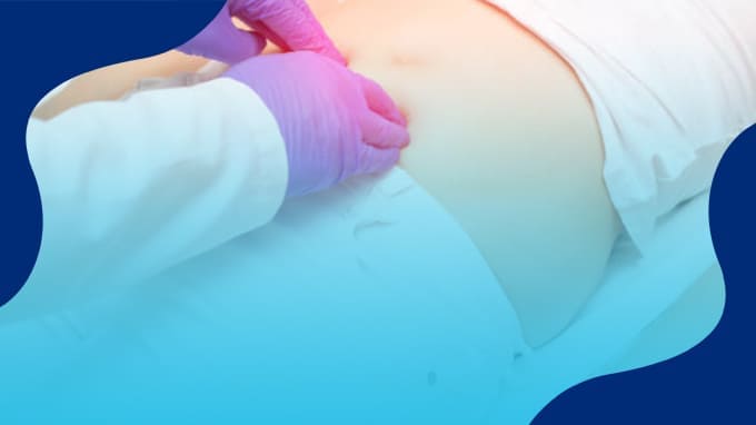 Precio de operación de Hernia Inguinal