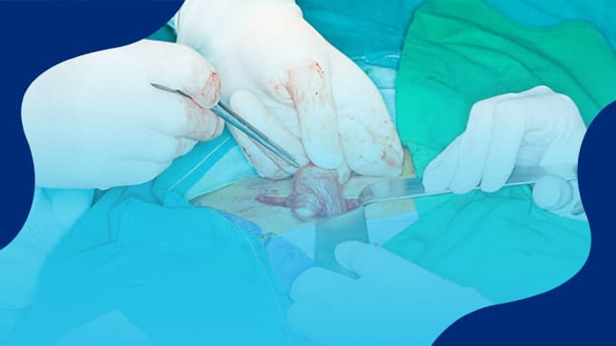 Precio de operación de Hernia Inguinal